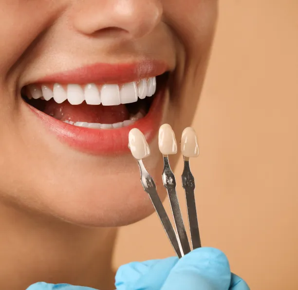 Dental veneers for University Heights patients