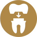 Dental Crowns