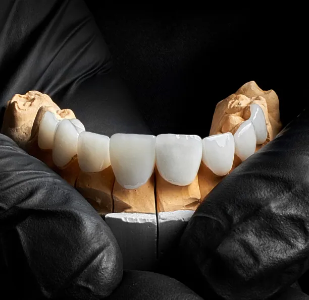 Dental veneers for Cleveland Heights patients